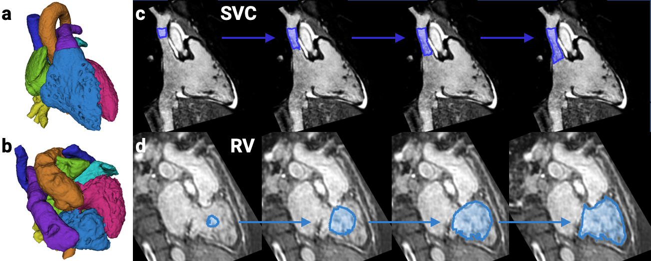 RNN-based segmentation of cardiac structures